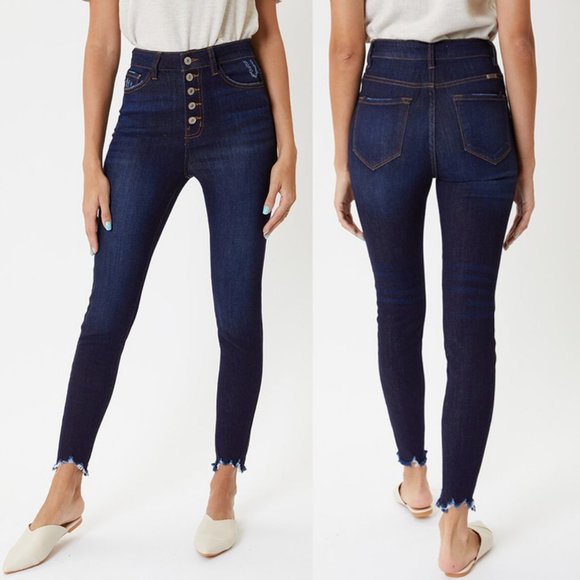 Terri Ultra High Rise Button Fly Super Skinny Jean - Picture 2 of 12